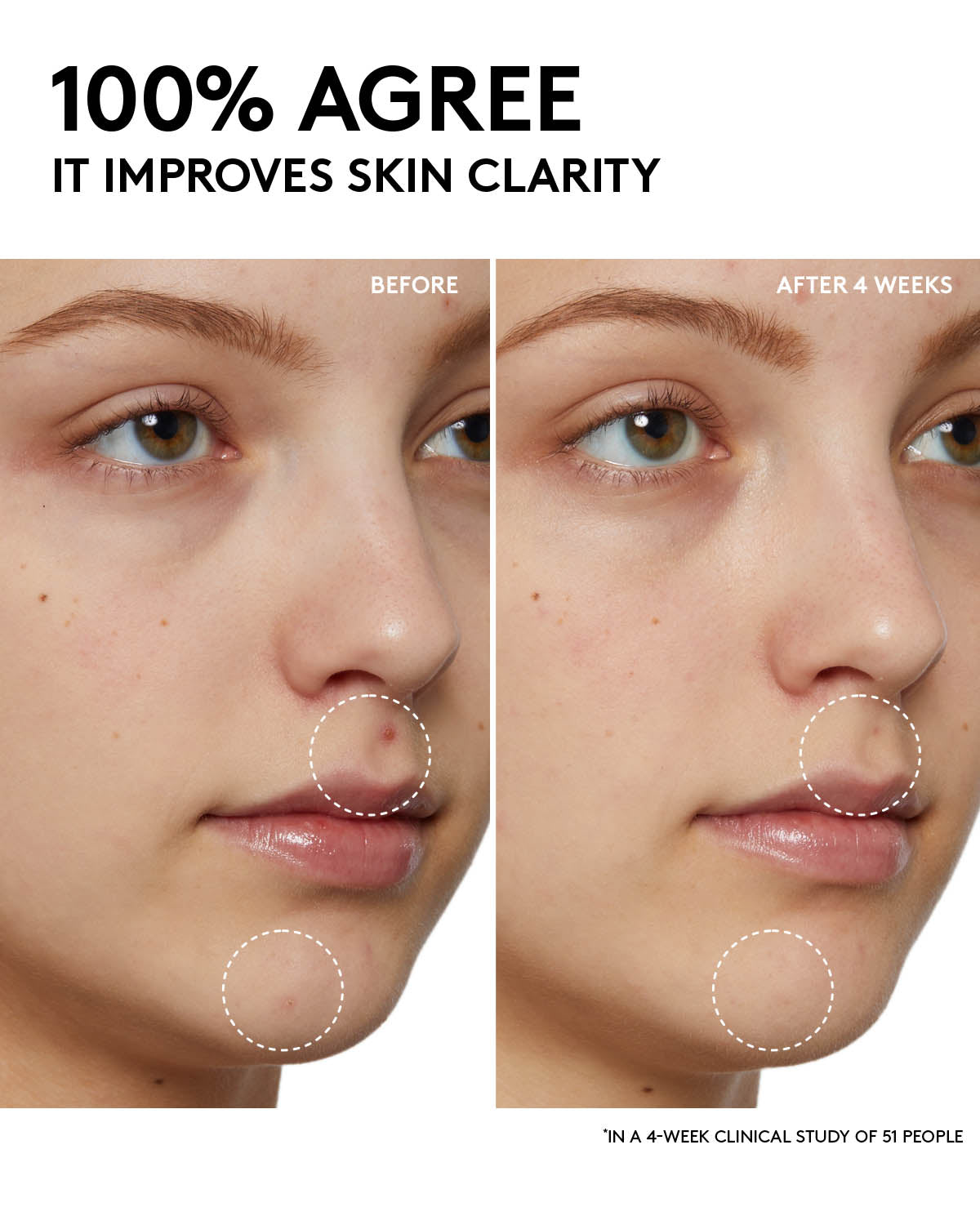 Cherry Dub Gel Cleanser with Niacinamide & Aloe for Oily Skin