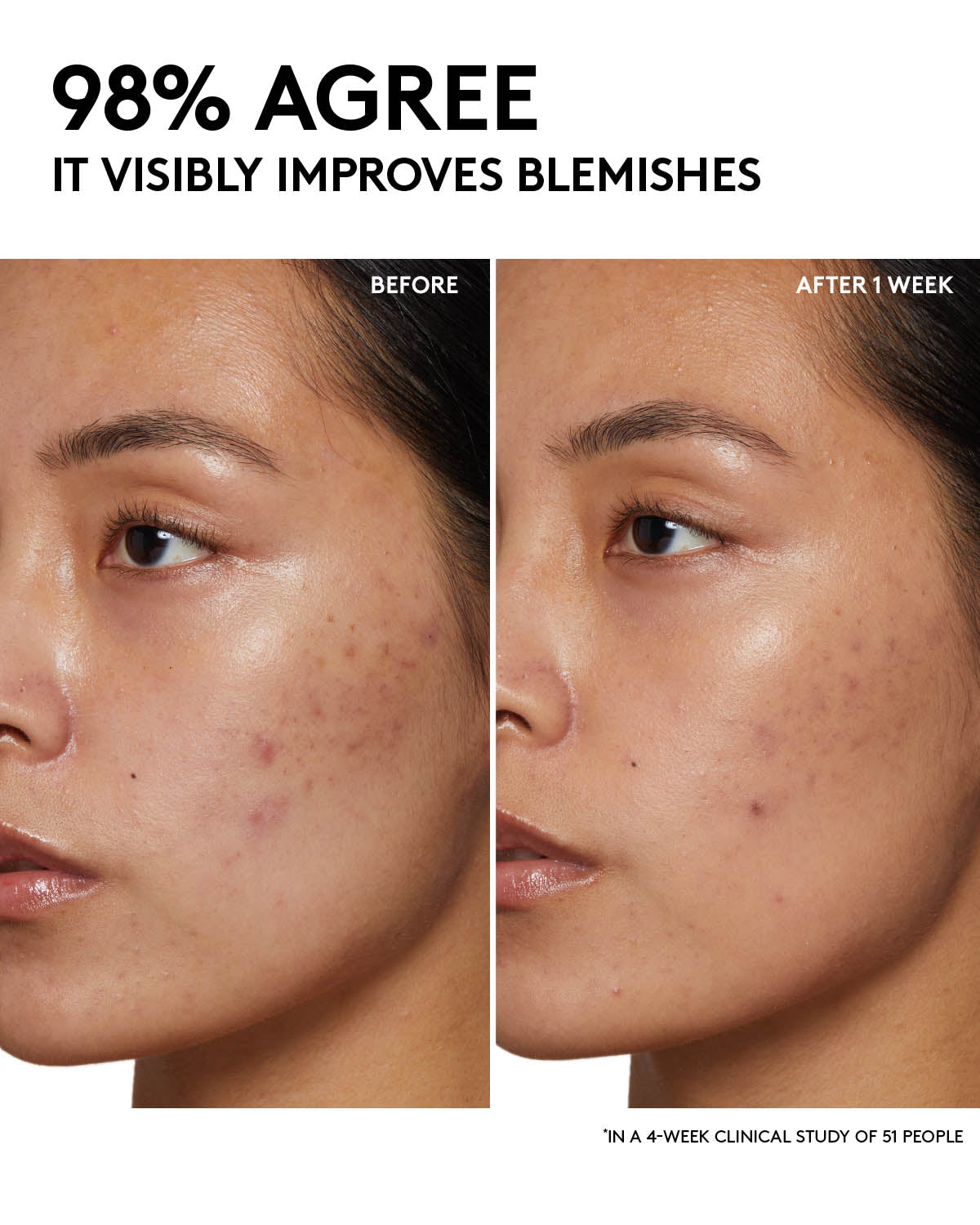 Cherry Dub Gel Cleanser with Niacinamide & Aloe for Oily Skin
