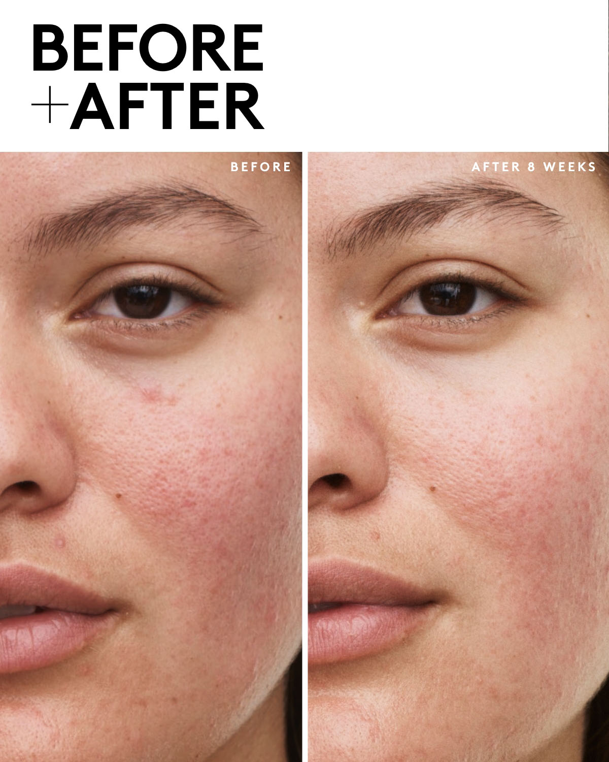 Fenty Skin 5-Piece AM + PM Skincare Set for Brightening & Hydration